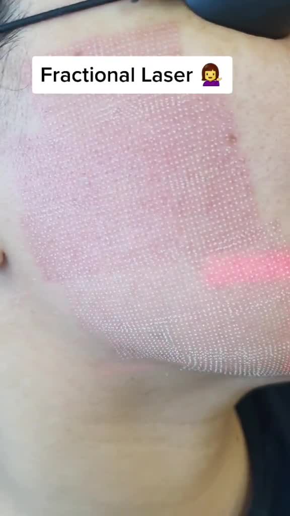 Suburban Laser and Skin Med Spa ad creative