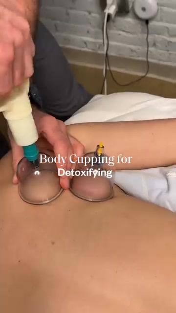 Acupuncture + Cupping: $90 for your first session with code: WELCOME20