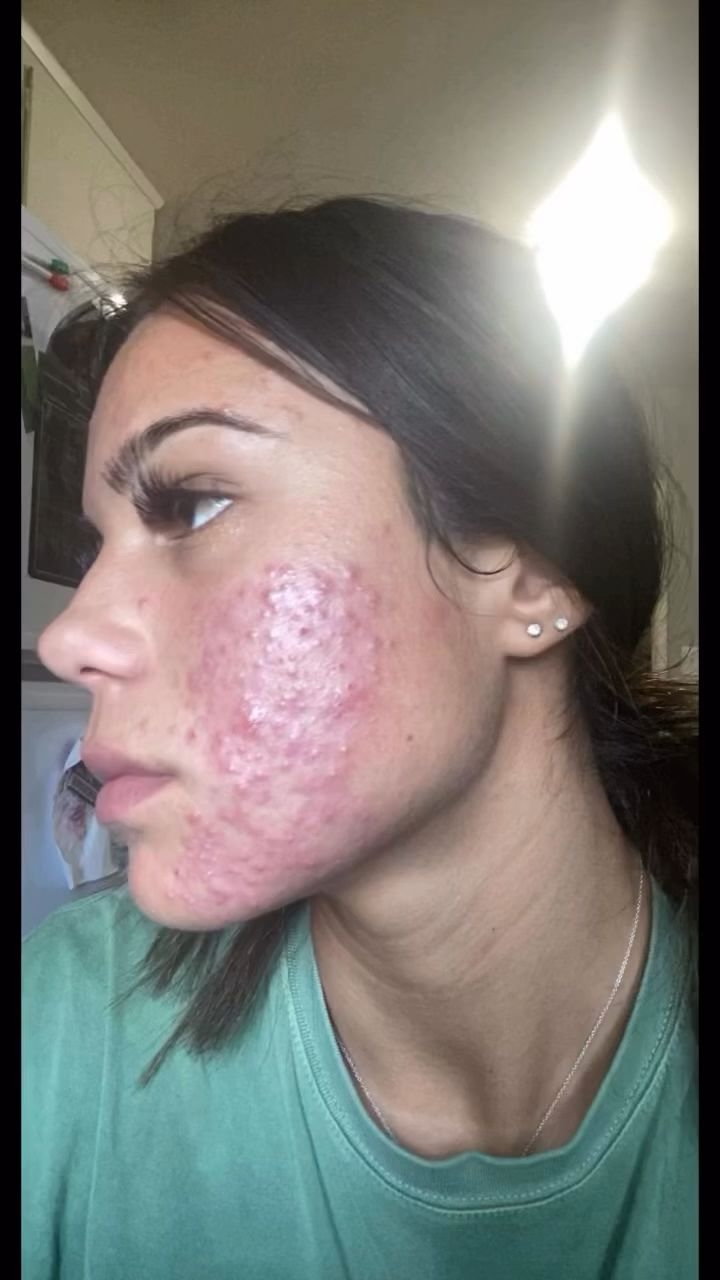 TROIAREUKE Lake Forest Med Spa ad creative