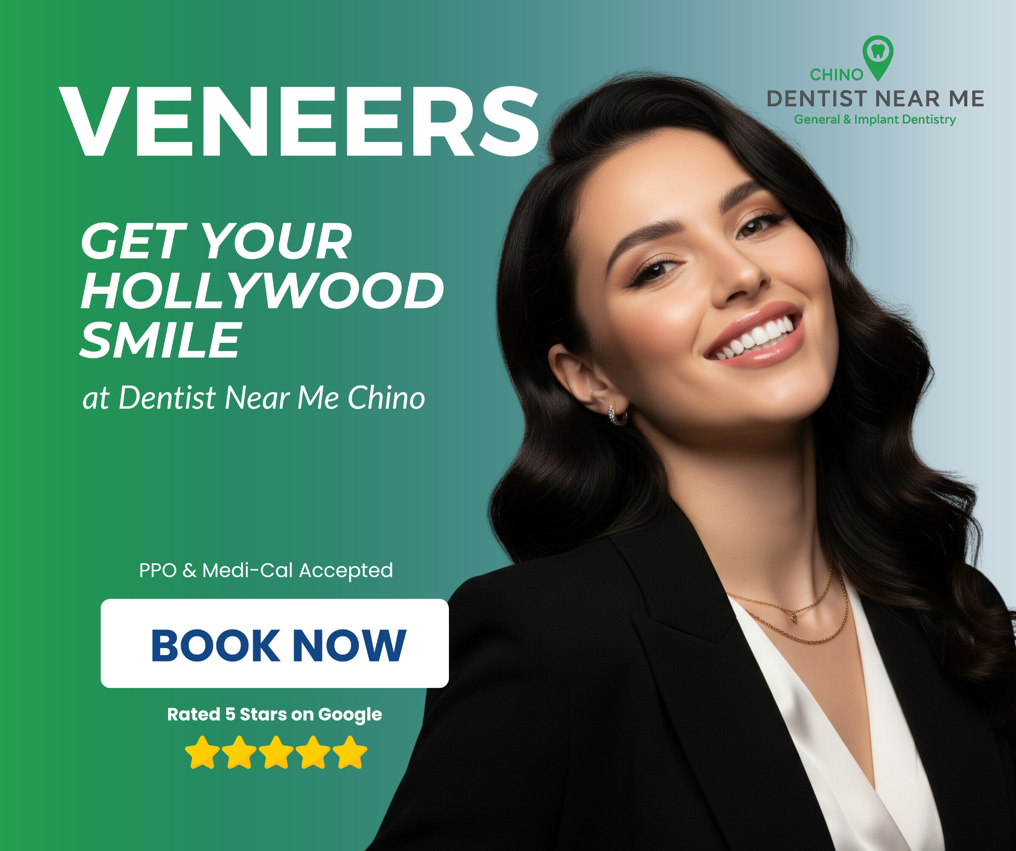 Instant Smile Makeover – Free Consultation