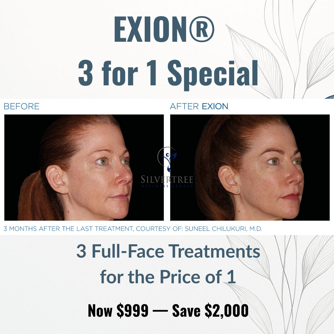 Silver Tree Wellness Center Med Spa ad creative