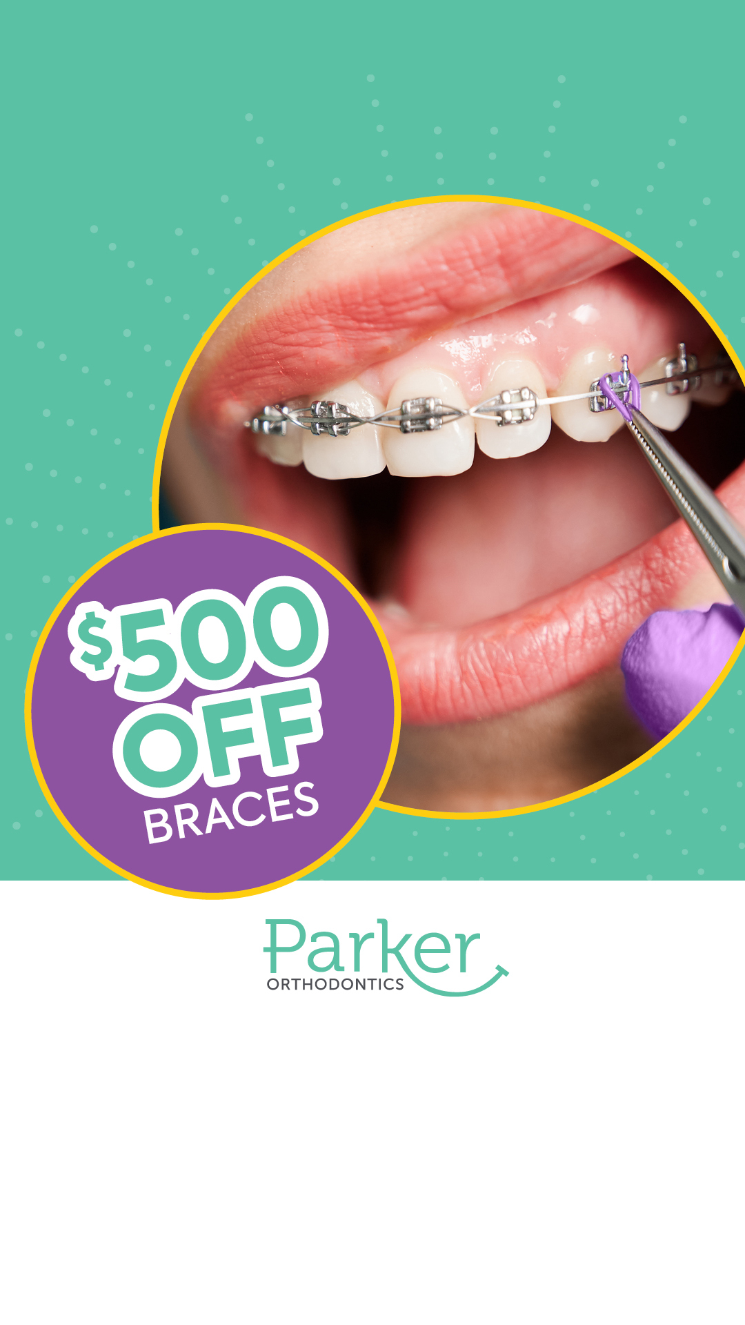 Braces for All Ages