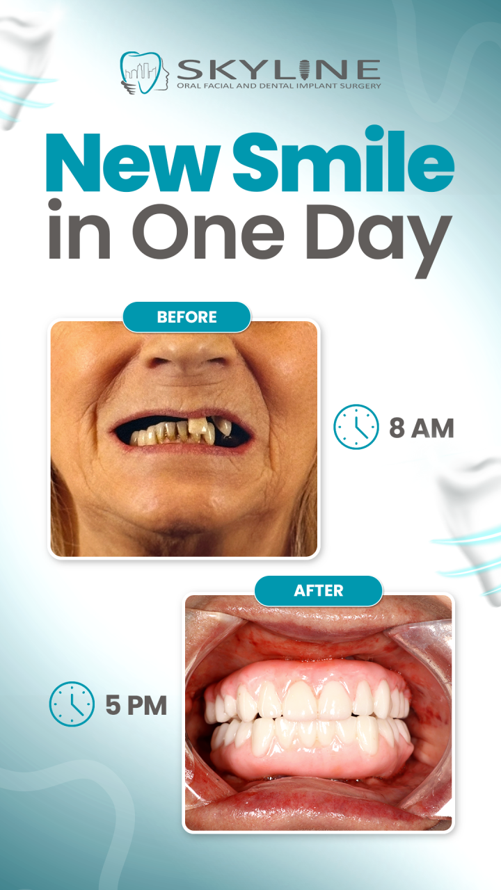 New Smile in One Day! ⏰😁 8am → 5pm