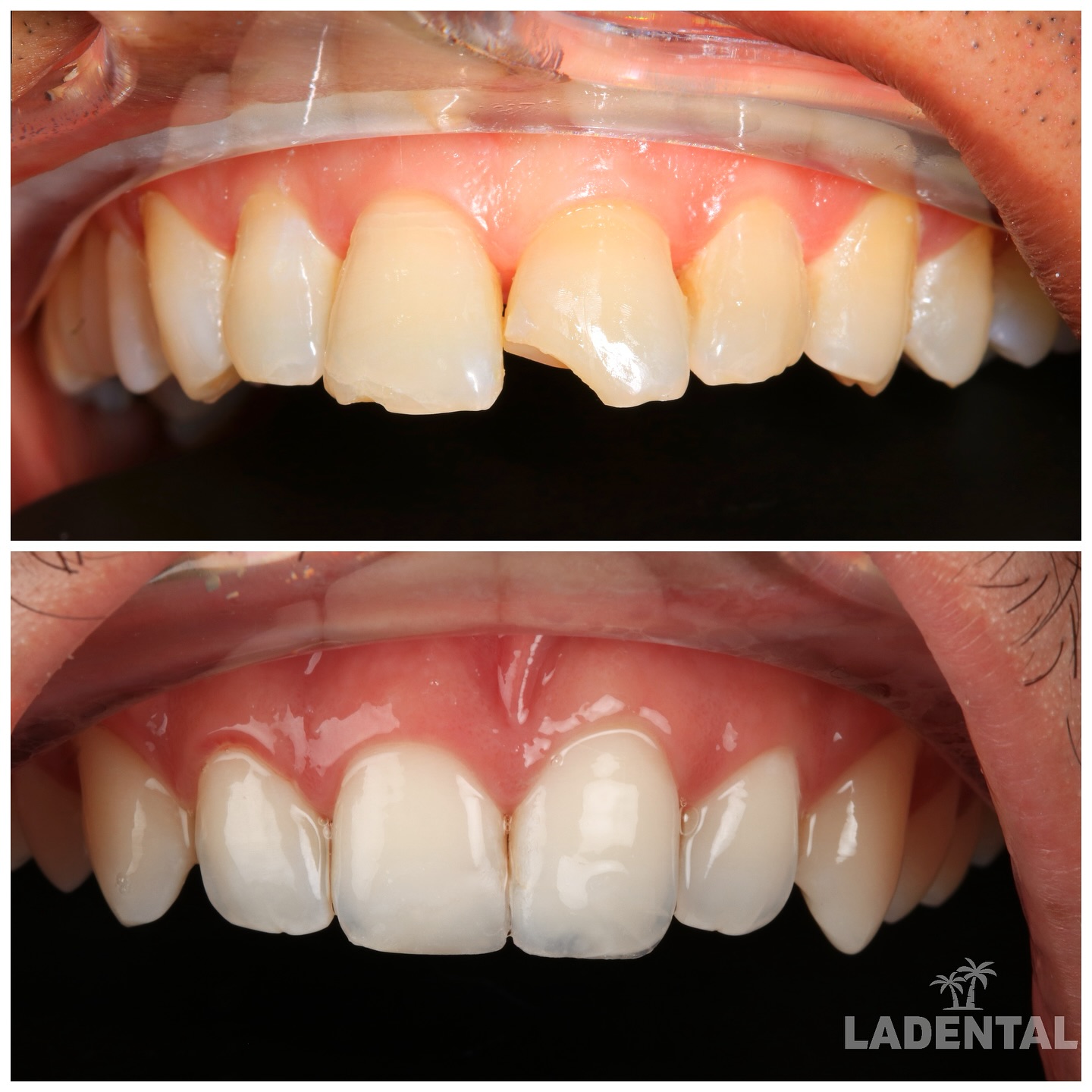 LA Dental Clinic: The Best Los Angeles Dentist