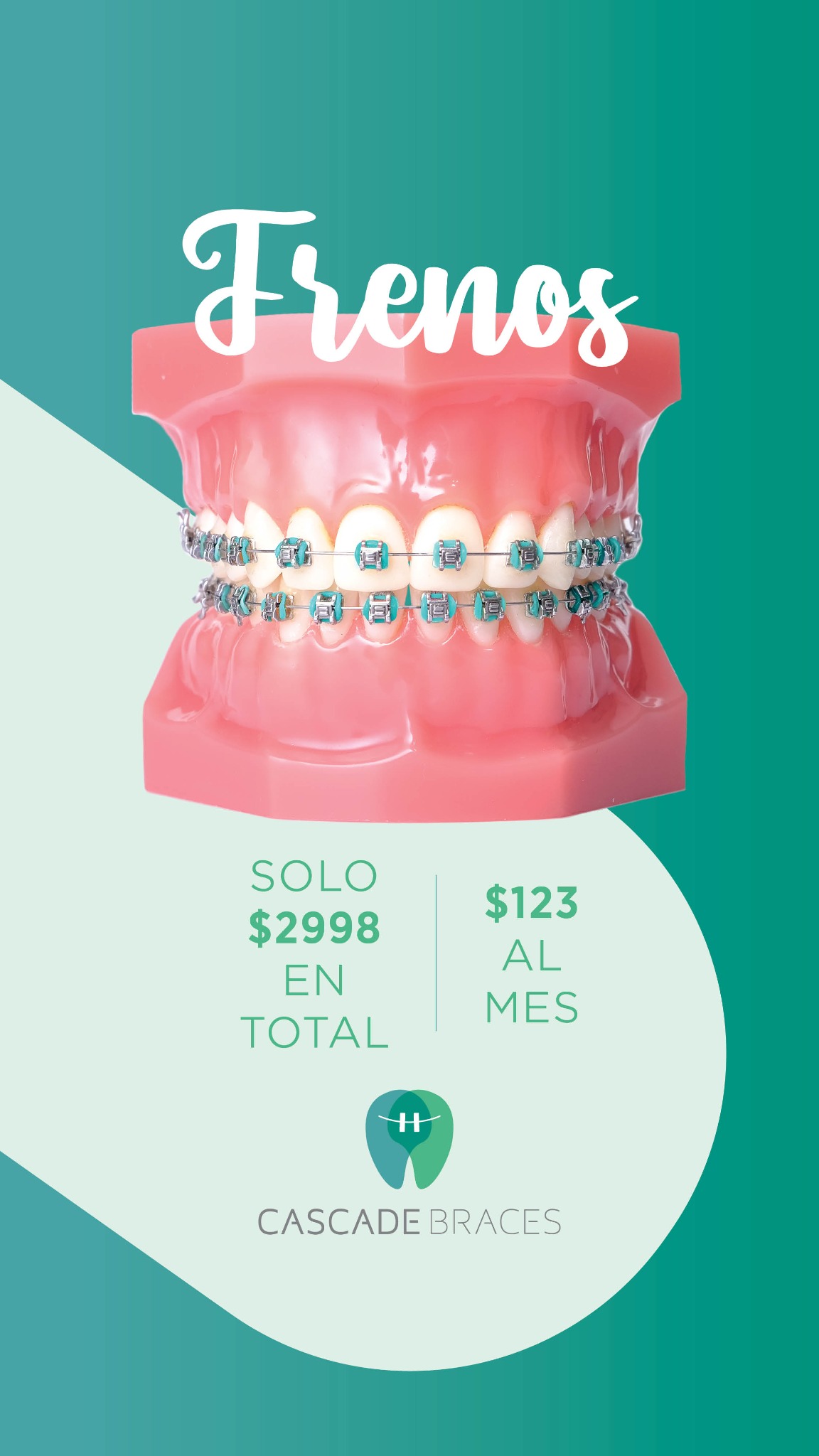 Frenos por un 60% menos