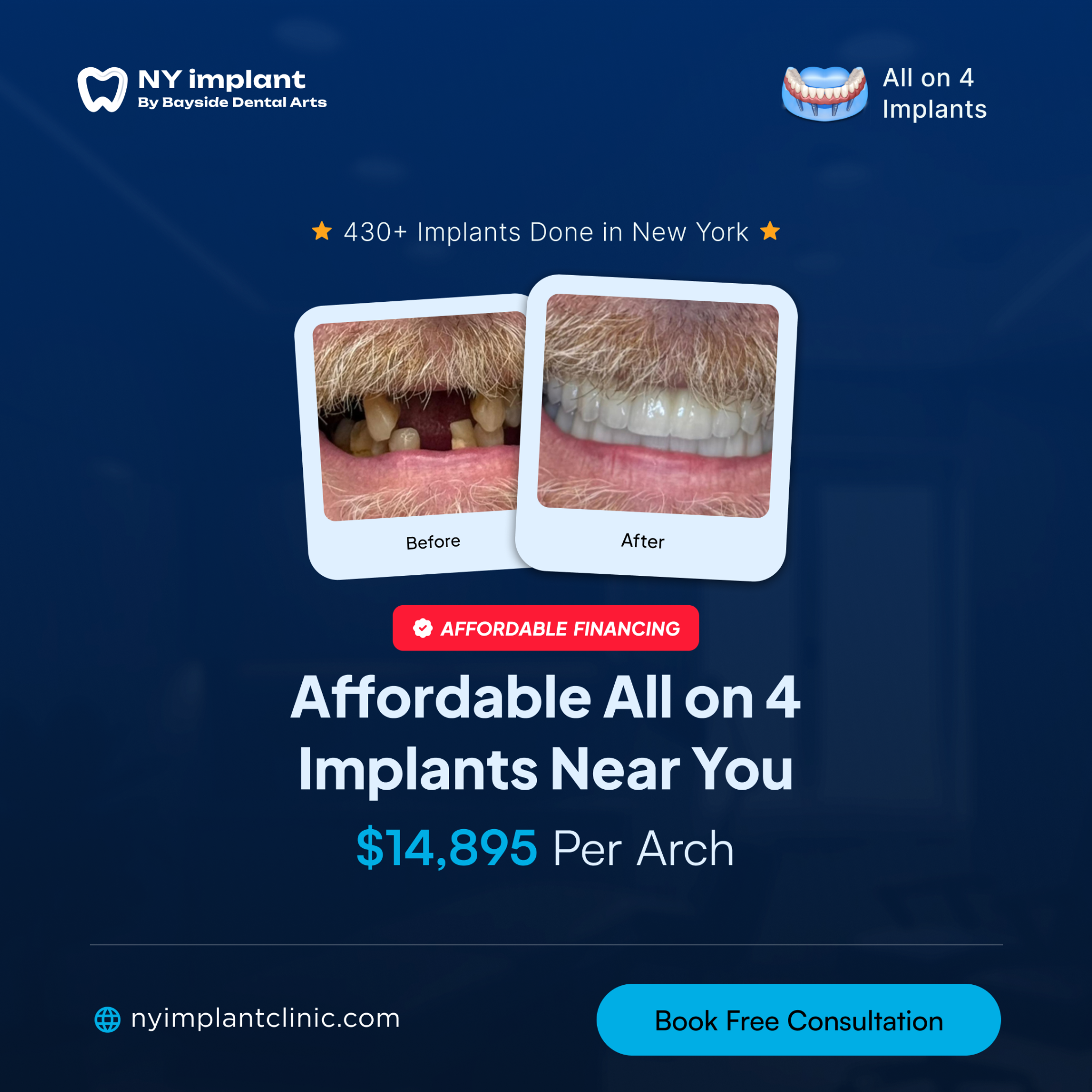 A Full Smile, Back in Your Life