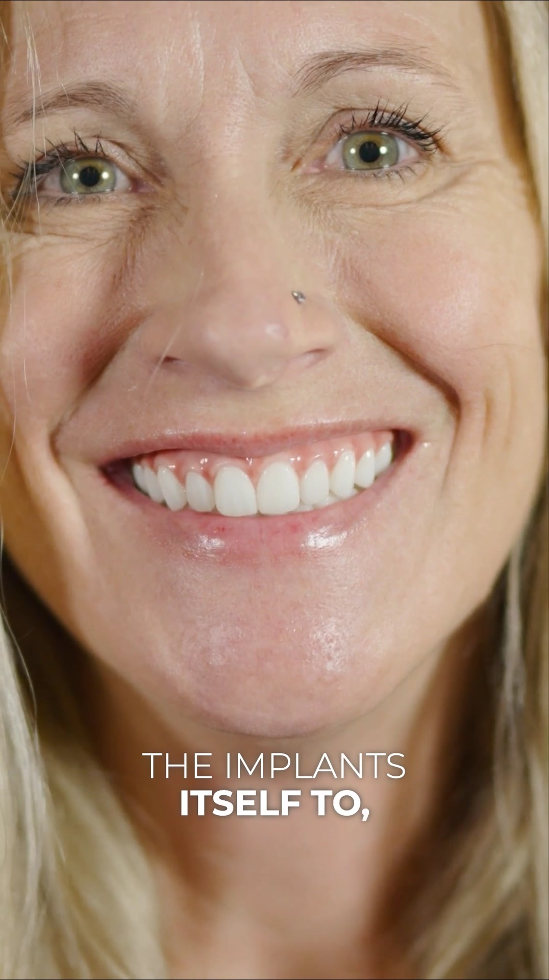 New Permanent Teeth Are Just 24 Hours Away!