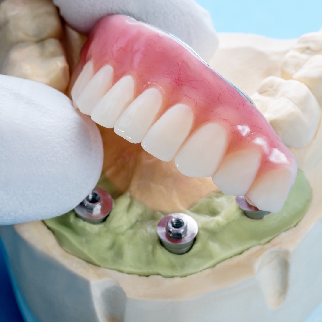 Mountain Smiles Dentistry General Dentist ad creative