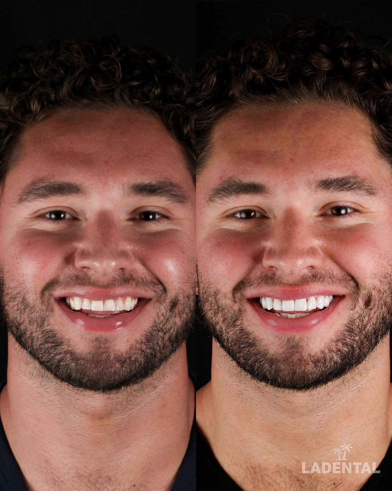 LA Dental Clinic: The Best Los Angeles Dentist