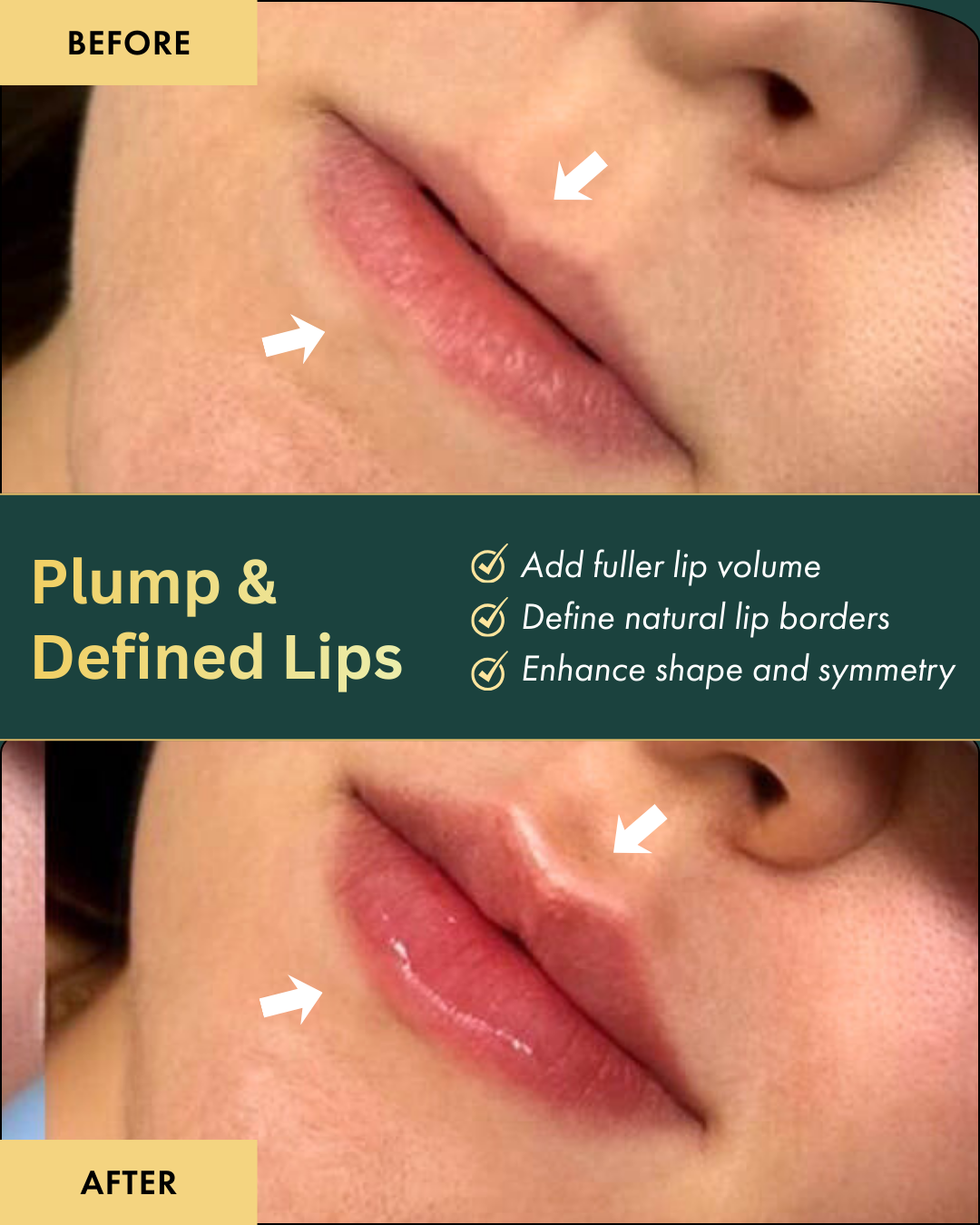 Parsa Wellness Clinic Chilliwack Med Spa ad creative