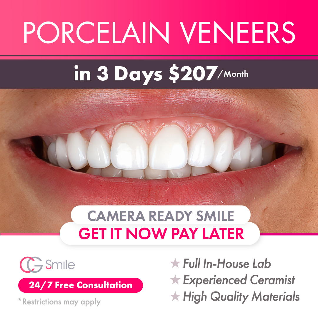 CG Smile Cosmetic Dentist ad creative