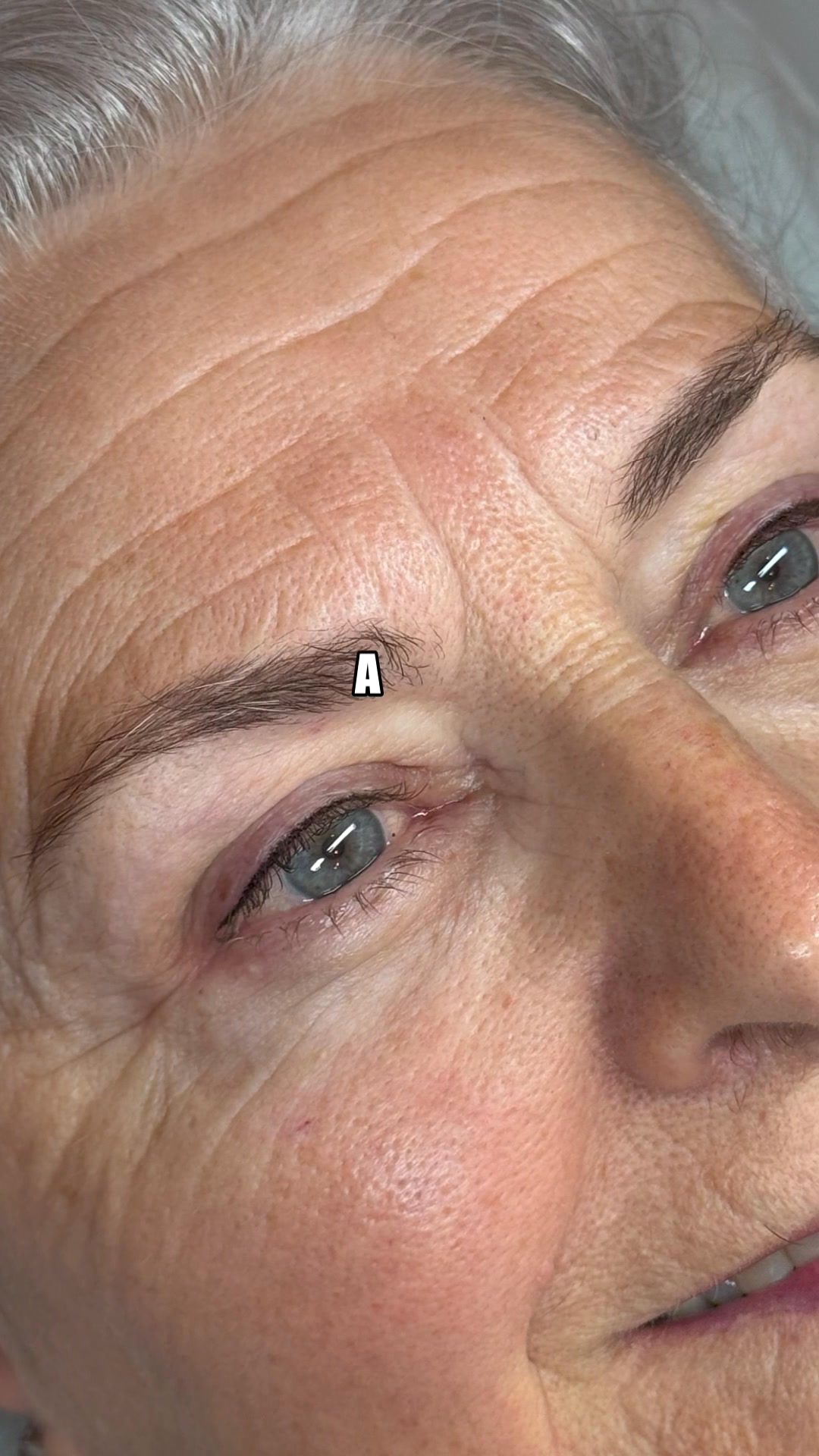 Feel confident in your own skin again