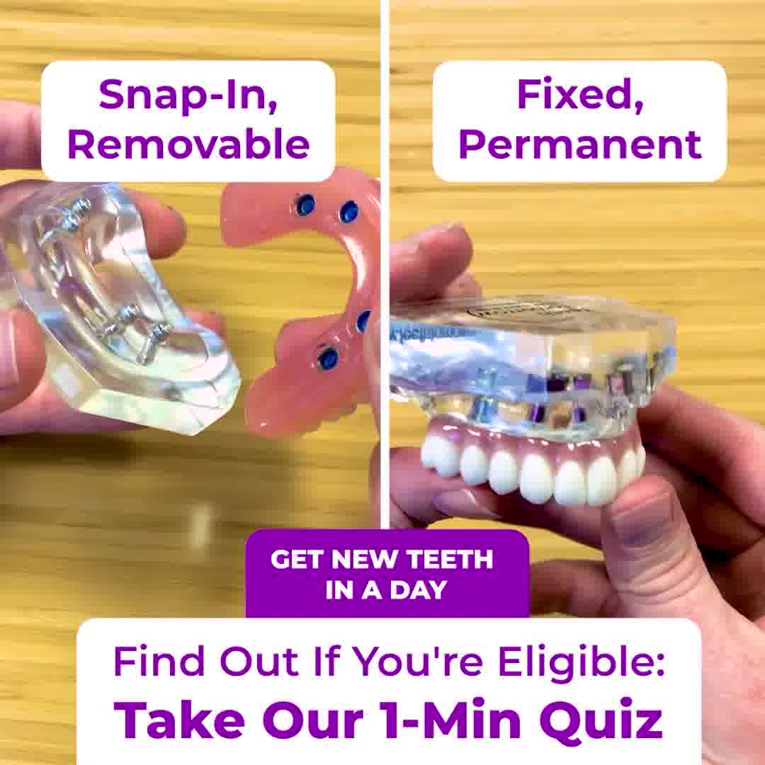 Discover Dental Implants Now