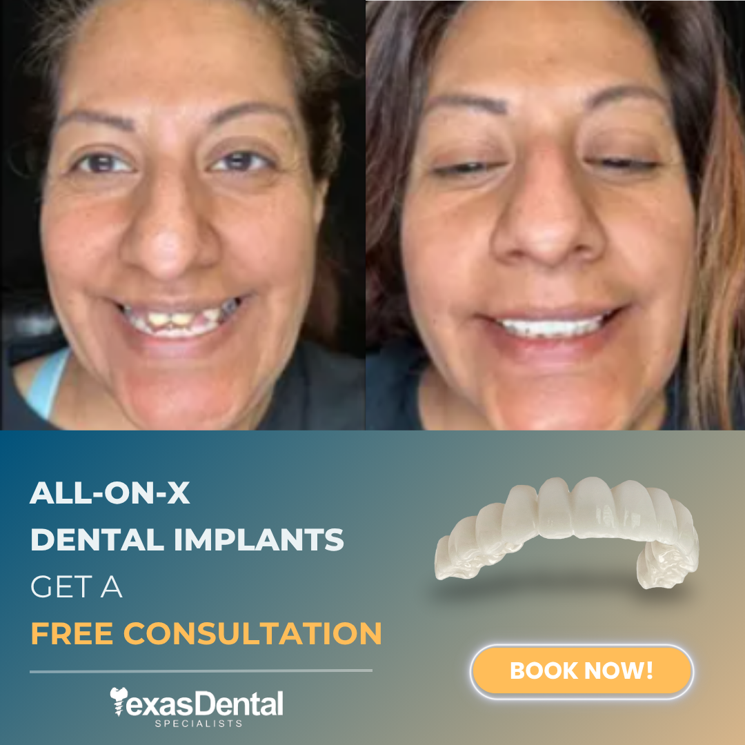 Texas Dental Specialists Implant Dentist ad creative