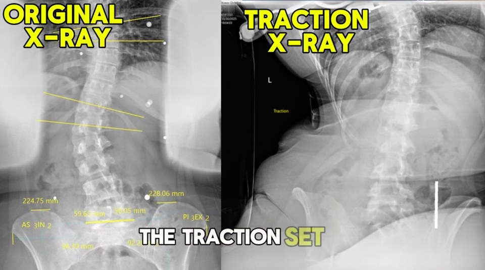 Gonstead Spine & Wellness Chiropractor ad creative