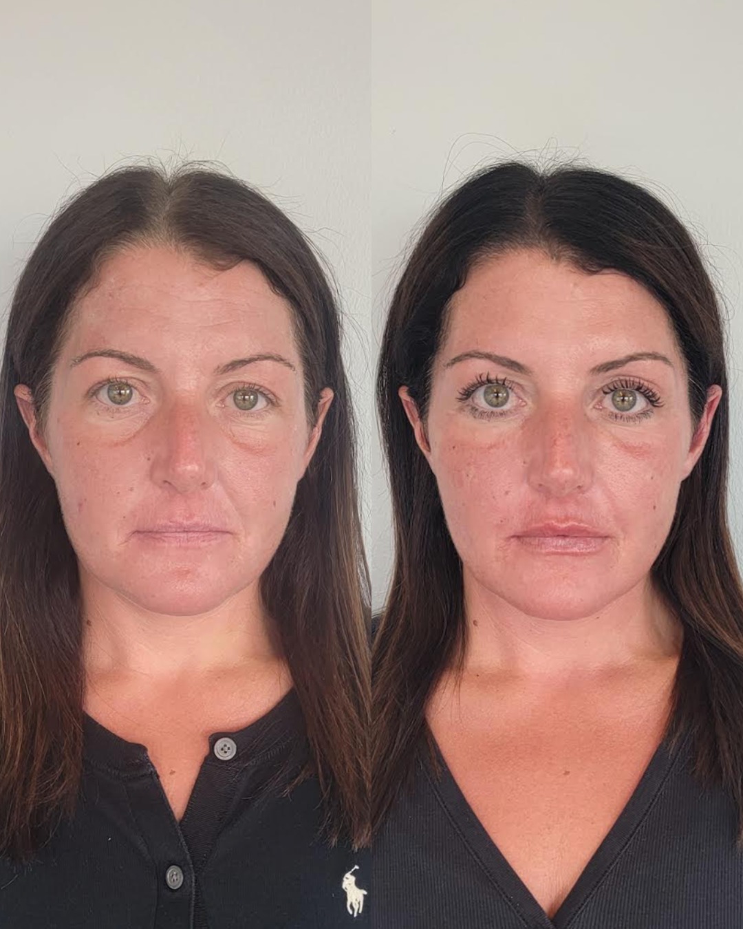 Cheeky Denver Med Spa ad creative