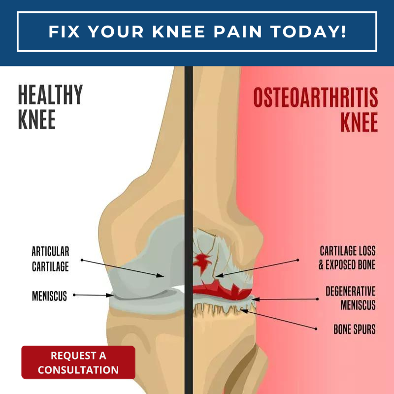 NEW Cutting-Edge Knee Pain Treatment For Your Best Results