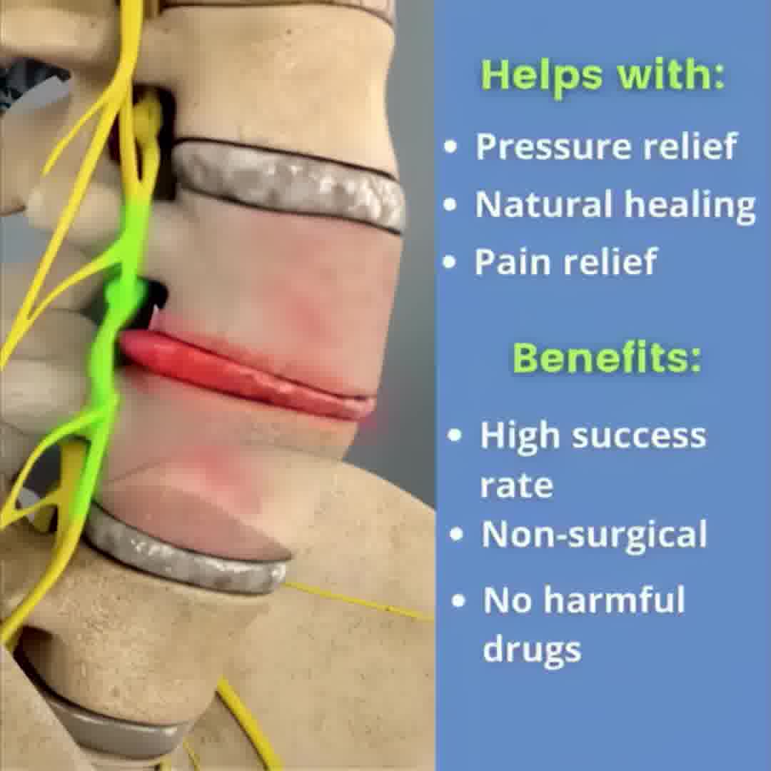 Non-Surgical Back Pain Treatment