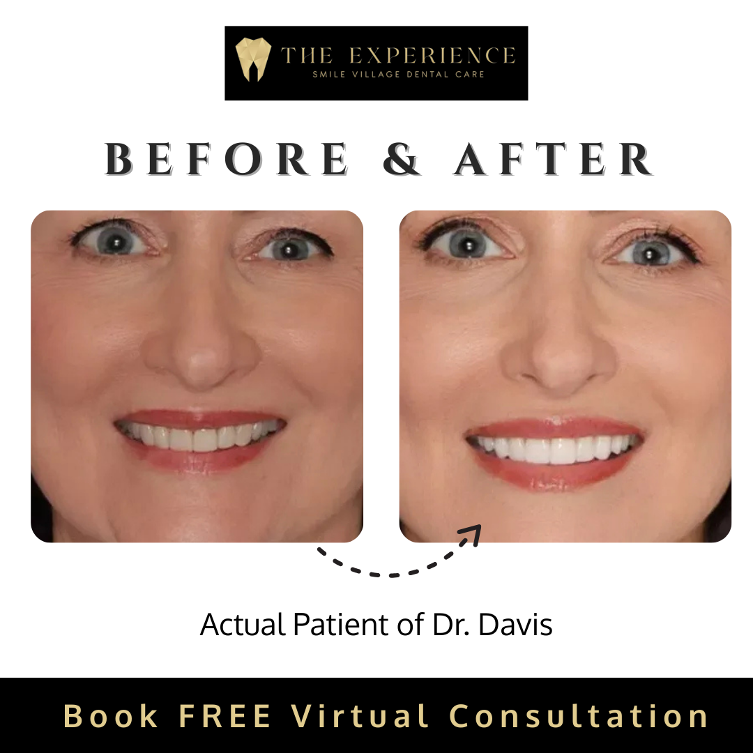 Discover Your Perfect Smile