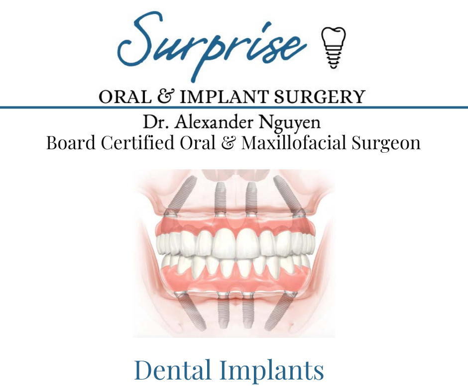 Dental Implant Experts