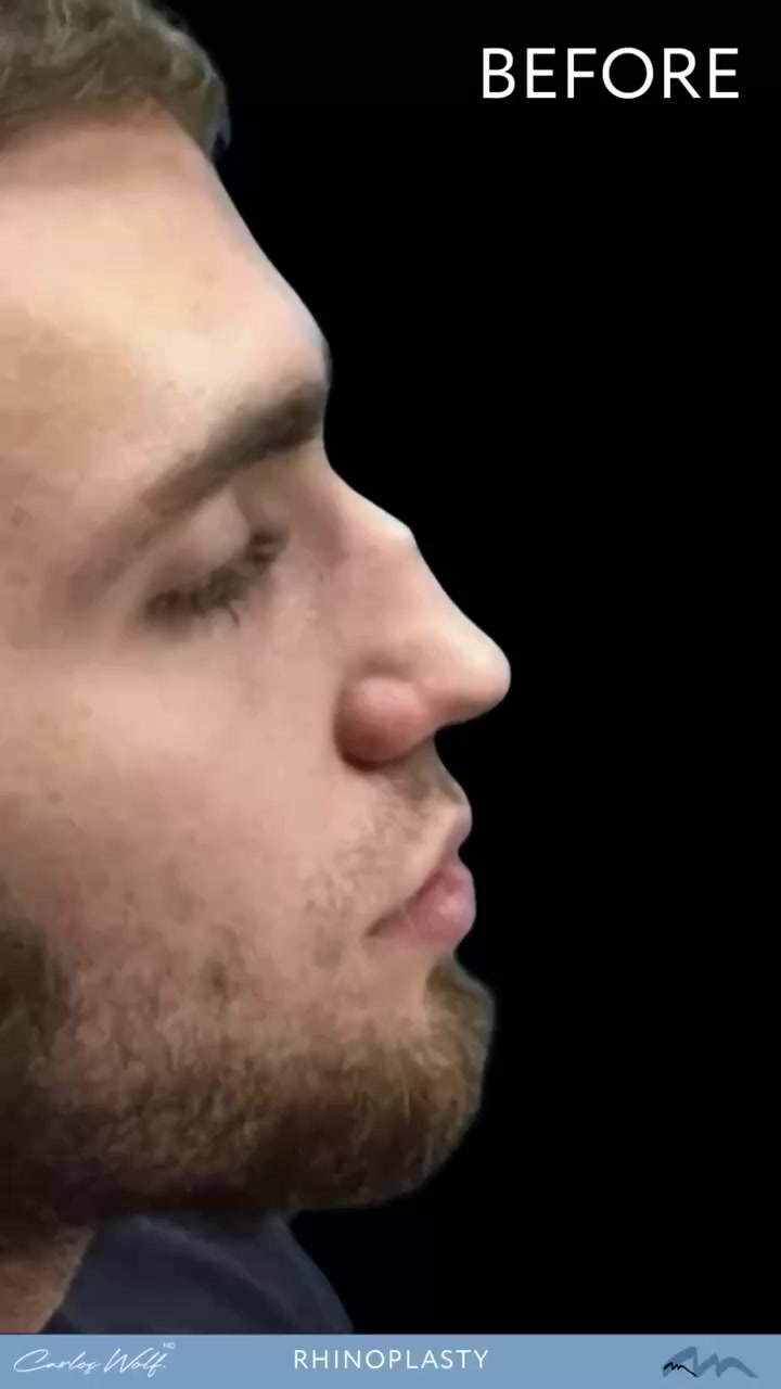 Miami Plastic Surgery Med Spa ad creative