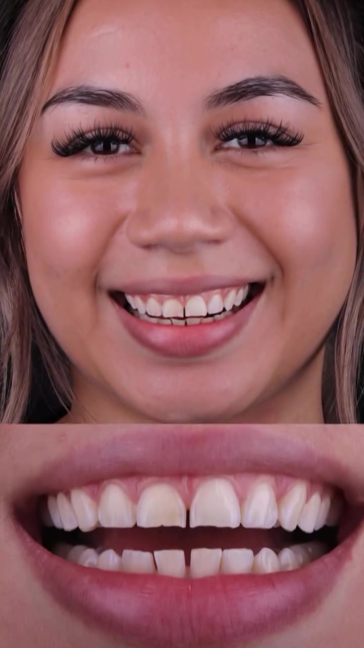 Dr. Antoun - Houston Cosmetic Dentist Cosmetic Dentist ad