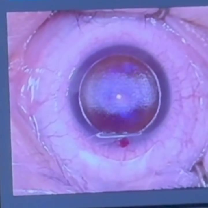 A Life With Clearer Vision Starts Here