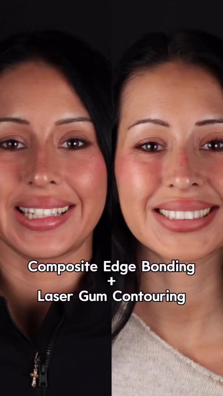 L.A. Dental Clinic Cosmetic Dentist ad