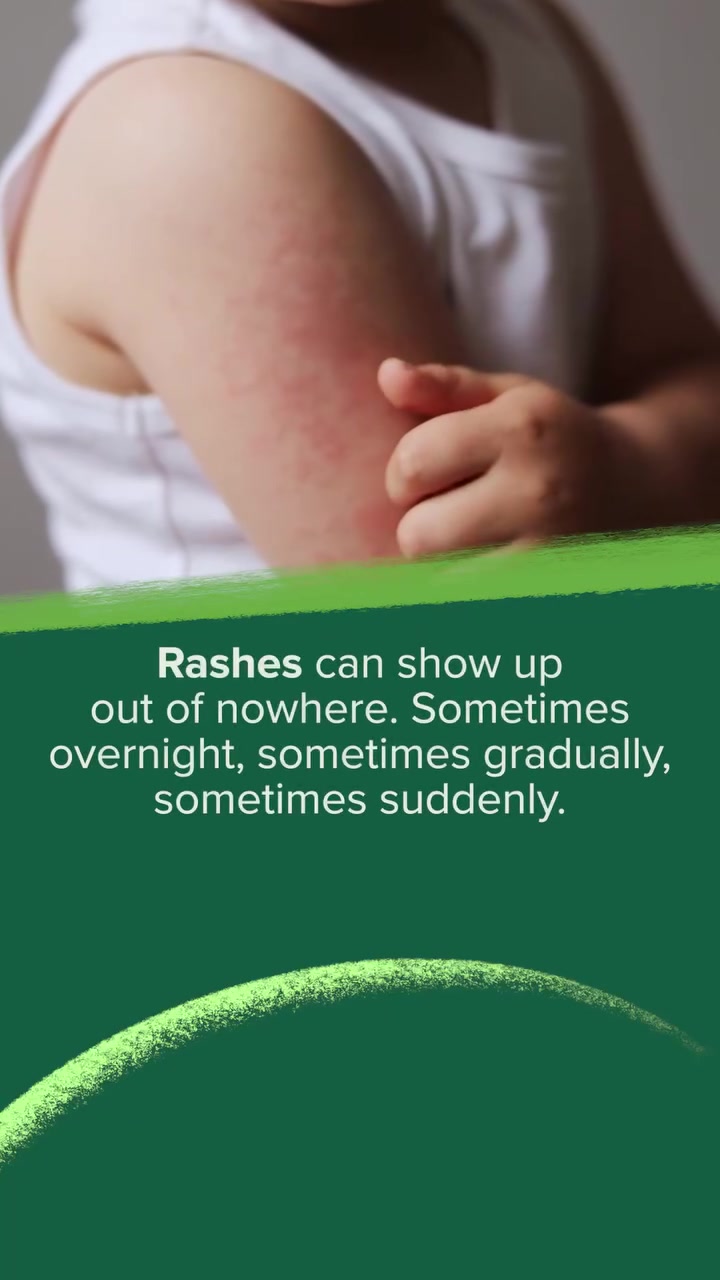Common Rashes