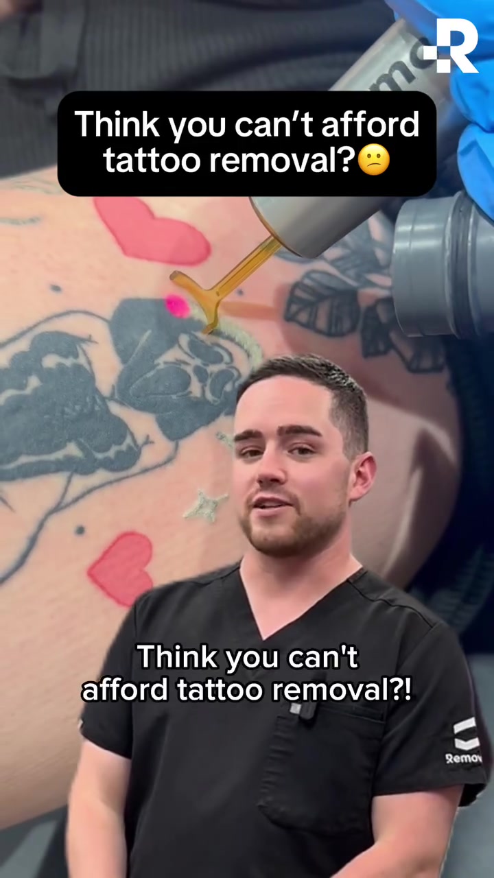 Removery: Affordable Tattoo Removal