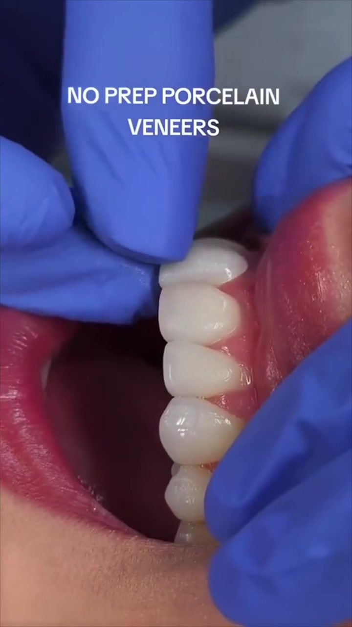 Hiding Your Smile? 😔