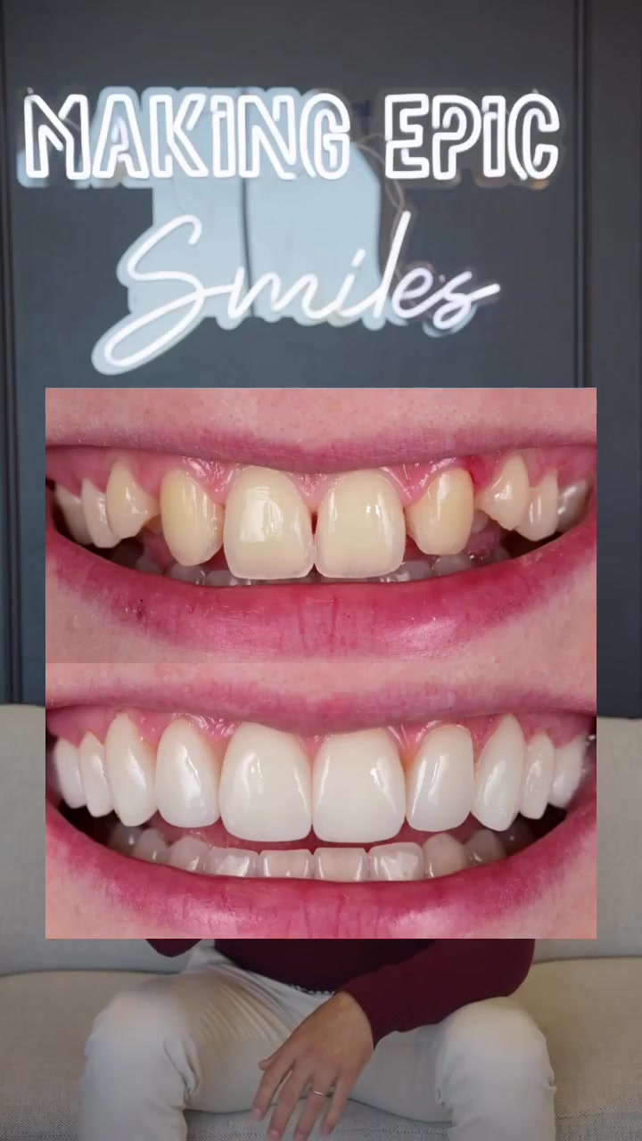Smiles by Dr. Michael Allen Cosmetic Dentist ad